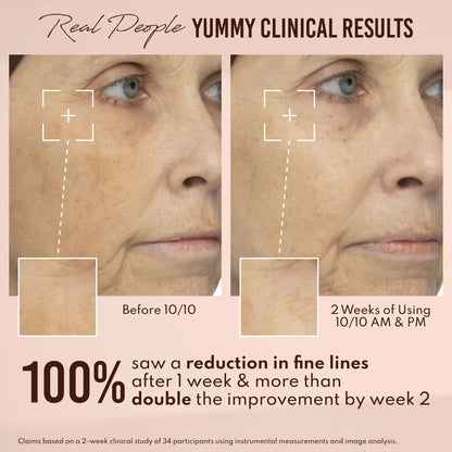 Yummy Skin 10/10 Barrier Boost Hyaluronic Acid + Ectoin Plumping Serum