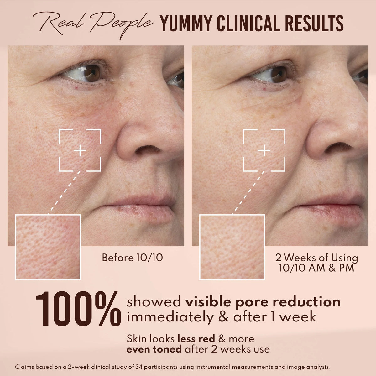 Yummy Skin 10/10 Barrier Boost Hyaluronic Acid + Ectoin Plumping Serum