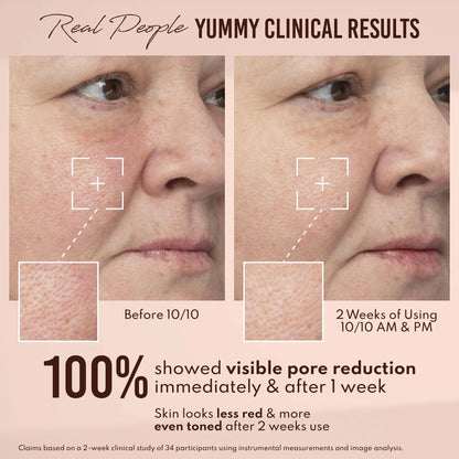 Yummy Skin 10/10 Barrier Boost Hyaluronic Acid + Ectoin Plumping Serum